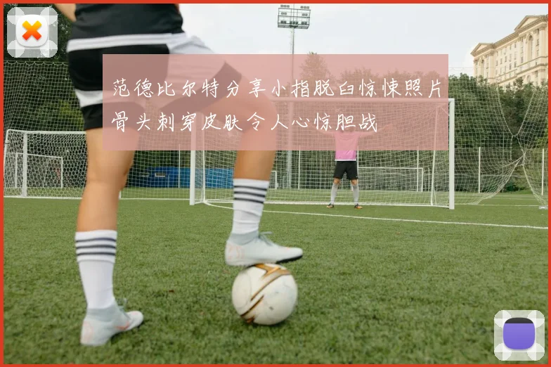 范德比尔特分享小指脱臼惊悚照片骨头刺穿皮肤令人心惊胆战